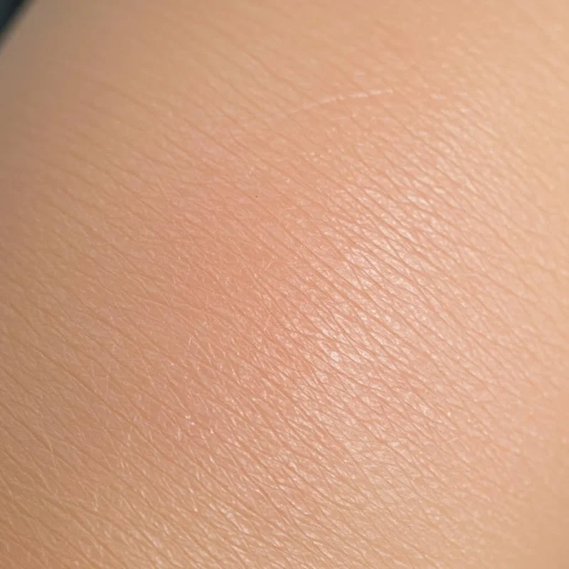 Microneedling for skin and hair